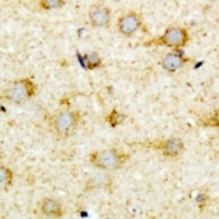 ACOX1 Rabbit Polyclonal Antibody
