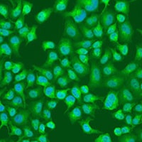 ACOX1 Rabbit Polyclonal Antibody