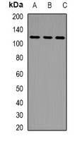 LLGL2 Rabbit Polyclonal Antibody