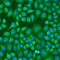 LLGL2 Rabbit Polyclonal Antibody
