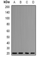 Centrin-3 Rabbit Polyclonal Antibody