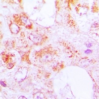 Centrin-3 Rabbit Polyclonal Antibody
