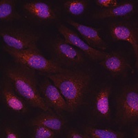 Centrin-3 Rabbit Polyclonal Antibody