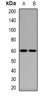 NPR-C Rabbit Polyclonal Antibody