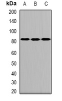 ALOXE3 Rabbit Polyclonal Antibody