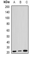ARL6 Rabbit Polyclonal Antibody