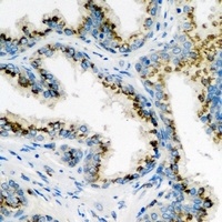 ARL6 Rabbit Polyclonal Antibody