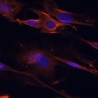 BAR Antibody