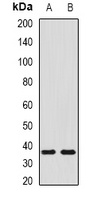 SHOX2 Rabbit Polyclonal Antibody