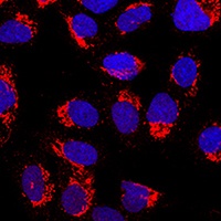 AP1-mu-2 Rabbit Polyclonal Antibody