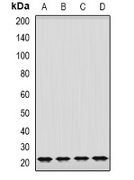 GrpEL2 Rabbit Polyclonal Antibody