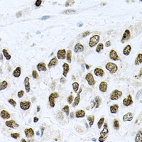 METTL3 Rabbit Polyclonal Antibody