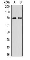 EME1 Rabbit Polyclonal Antibody