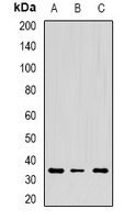 CD272 Rabbit Polyclonal Antibody