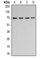 ACAD9 Antibody