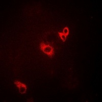 ACAD9 Antibody