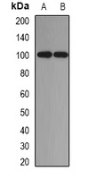 ADAM9 Rabbit Polyclonal Antibody
