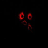 ADAM9 Rabbit Polyclonal Antibody