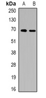 ALB Antibody