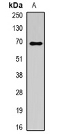 ALB Antibody