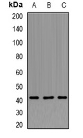 APTX Rabbit Polyclonal Antibody