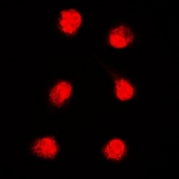 APTX Rabbit Polyclonal Antibody