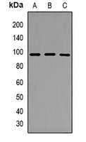 DRIL1 Rabbit Polyclonal Antibody