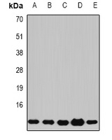 Beta 2 Microglobulin Rabbit Polyclonal Antibody
