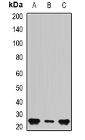 BAG2 Rabbit Polyclonal Antibody