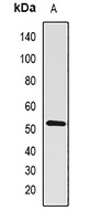 BMPR1B Rabbit Polyclonal Antibody