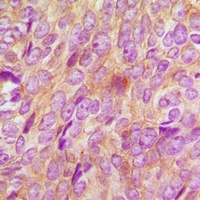 BMPR1B Rabbit Polyclonal Antibody