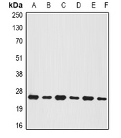 BNIP1 Rabbit Polyclonal Antibody