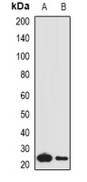 Complement C1QA Rabbit Polyclonal Antibody