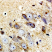 Complement C1QA Rabbit Polyclonal Antibody