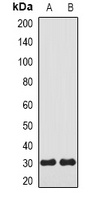 Carbonic Anhydrase 3 Rabbit Polyclonal Antibody