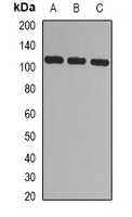 CBLB Rabbit Polyclonal Antibody