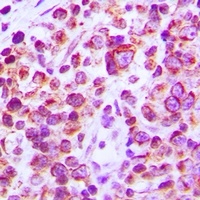 CD38 Antibody