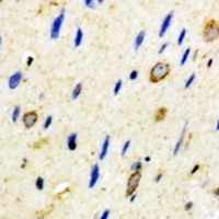CD59 Rabbit Polyclonal Antibody