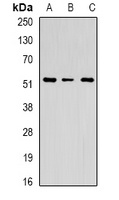 Chitotriosidase Antibody