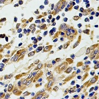 Chitotriosidase Antibody
