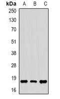 CIRBP Rabbit Polyclonal Antibody