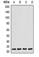 CLEC12A Rabbit Polyclonal Antibody