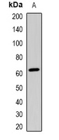CRY1 Rabbit Polyclonal Antibody