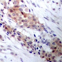 CRY1 Rabbit Polyclonal Antibody