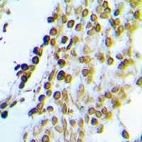 CK2 alpha Rabbit Polyclonal Antibody