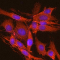 CK2 alpha Rabbit Polyclonal Antibody