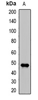 DDB2 Rabbit Polyclonal Antibody