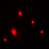 DDB2 Rabbit Polyclonal Antibody