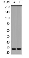 DKK4 Rabbit Polyclonal Antibody
