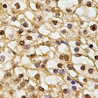 DNAJB6 Rabbit Polyclonal Antibody